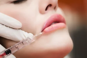 wie viel kostet lippen aufspritzen